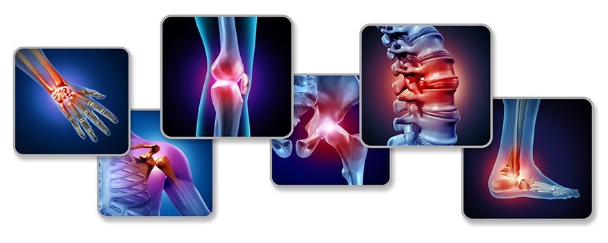 Joint Pain Redondo Beach, CA