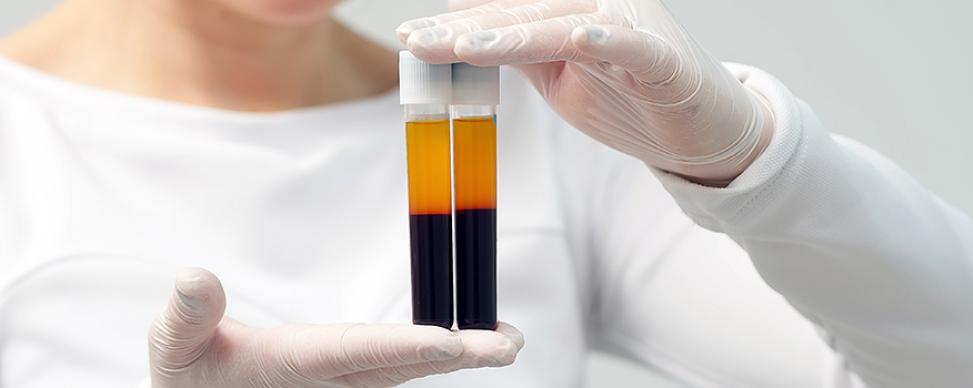 PRP therapy recovery at Syn Wellness Center in Redondo Beach, CA