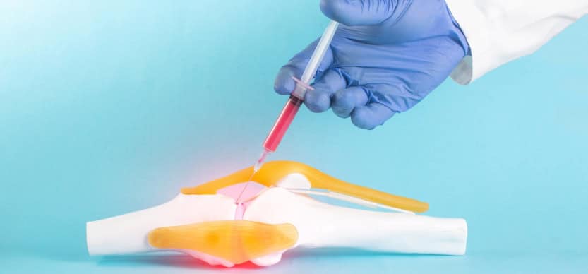 Regenerative Medicine and PRP